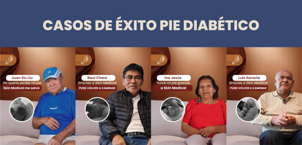 Especialistas en pie diabético